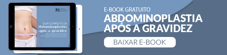 eBook - Abdominoplastia após a Gravidez